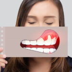 牙齦為什麼會萎縮，常見原因為何？